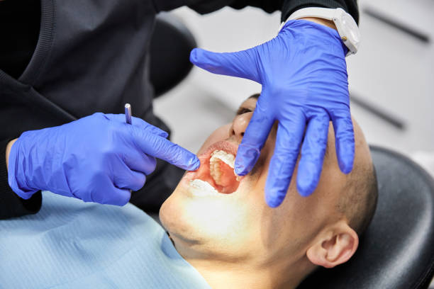 Best Broken or Cracked Tooth Emergency Dentist in Mammoth Lakes, CA